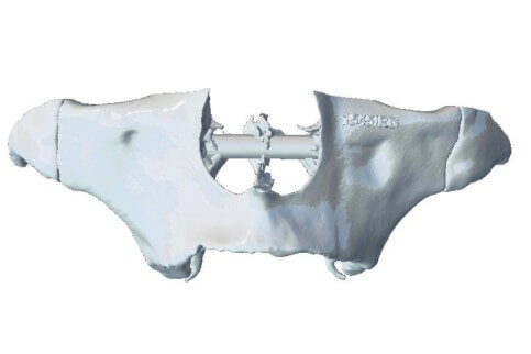 caso real zygomáticos Ammonite 03