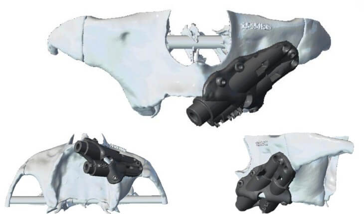 caso real zygomáticos Ammonite 08