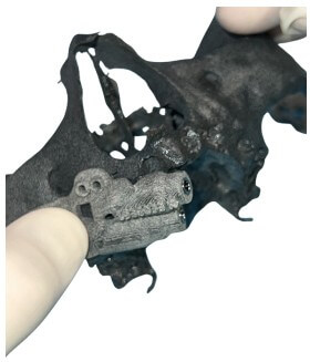 caso real zygomáticos Ammonite 10