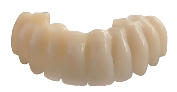 caso real zygomáticos Ammonite 14