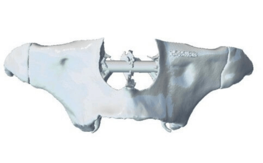 caso real de zygomáticos Ammonite 002